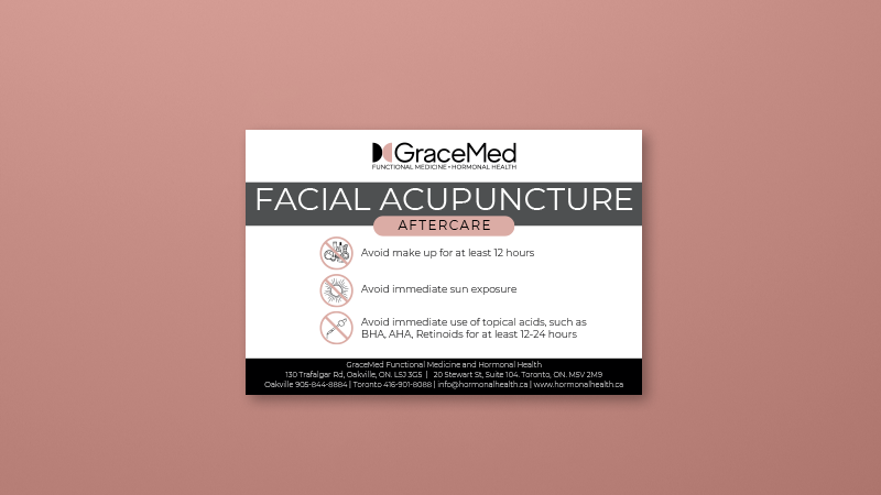 AFTERCARE Facial Acupuncture Cards